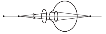 HBSE Class 10 Physics Solutions For Chapter 2 Defect of the eye