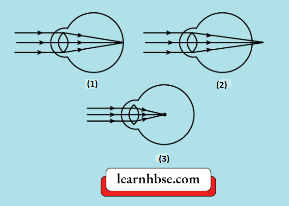 HBSE Class 10 Physics Solutions For Chapter 2 The Hypermetropia Eye