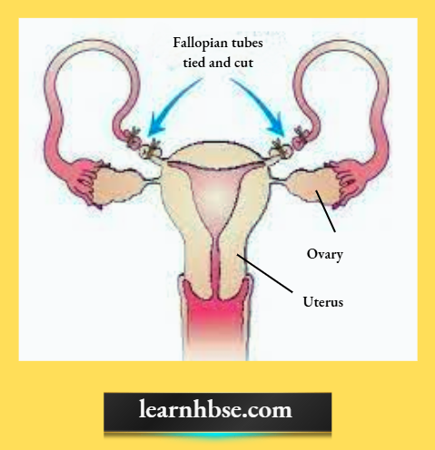 HBSE Solutions Class 10 Biology Chapter 2 A Surgical Method In Females To Prevent Pregnancy